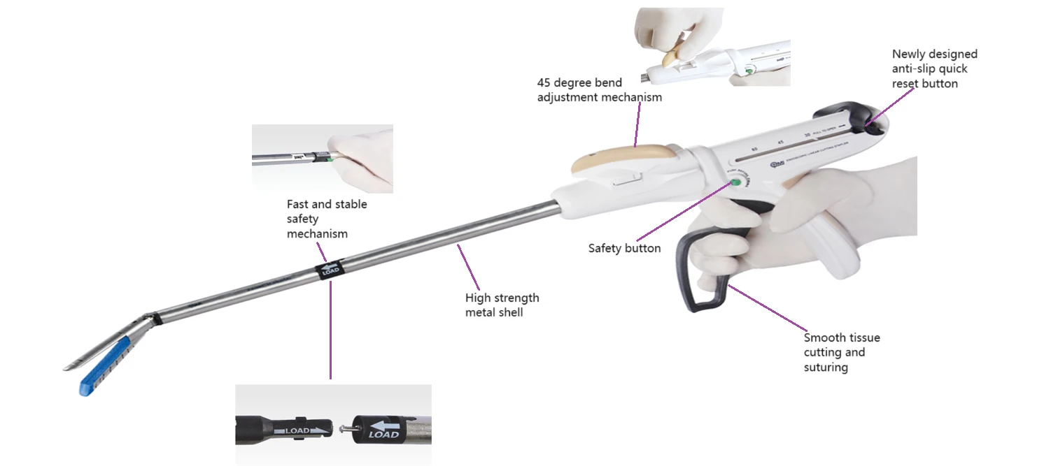 endoscopic linear cutter1